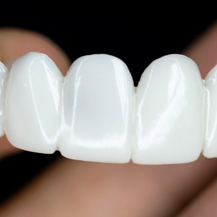 Snap On Teeth Veneers, Removable Snap On Veneers – image 4