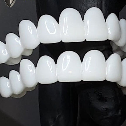 Snap On Teeth Veneers, Cosmetic Teeth Covers for Smile Makeover – image 5