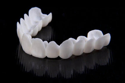 Removable Snap On Veneers – image 6