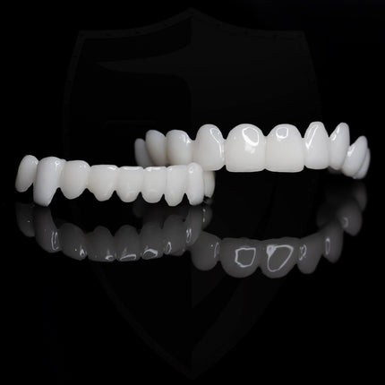 Snap On Teeth Veneers – image 9